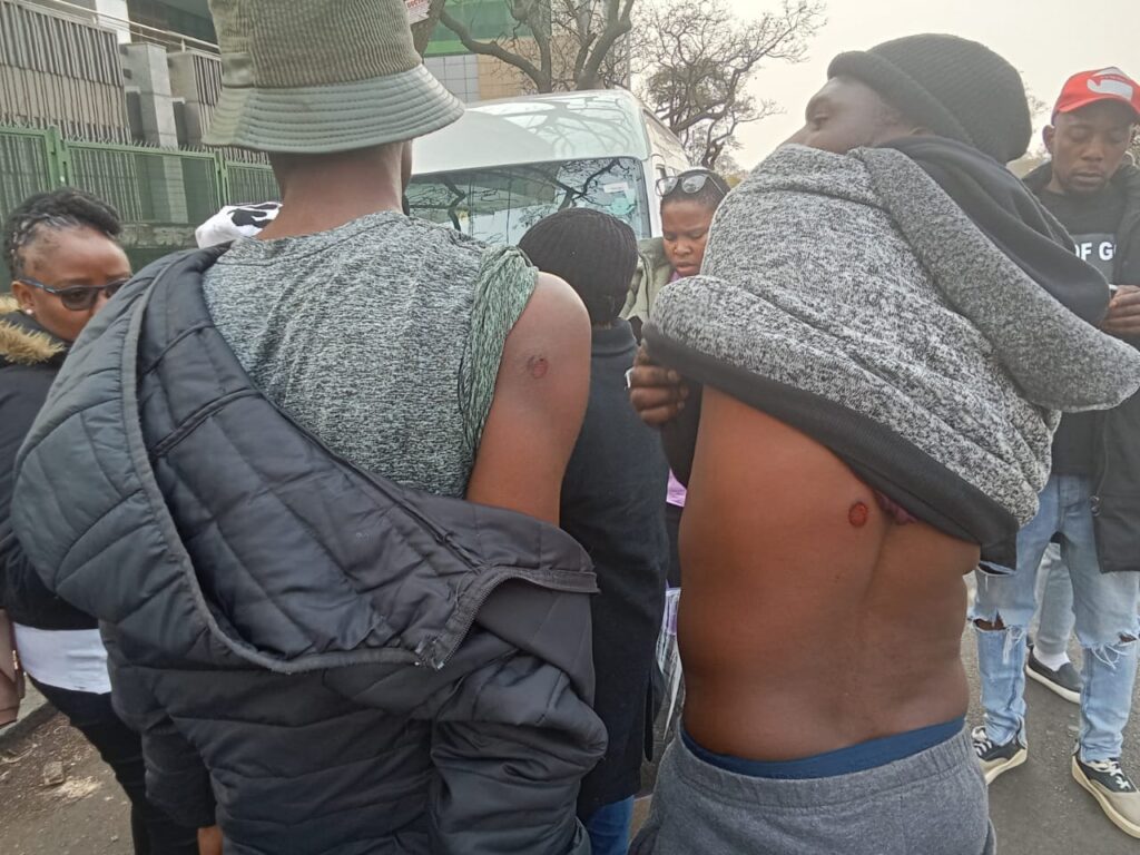 Two former assistance teachers shot with rubber bullet in Tshwane photo by Dimakatso Modipa 